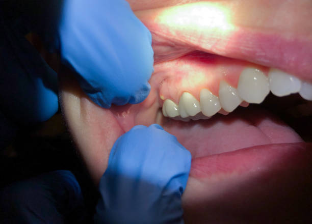 Best Pediatric Emergency Dentist in Wendover, UT