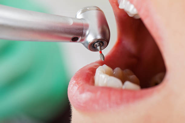 Best Emergency Treatment for Toothache in Wendover, UT